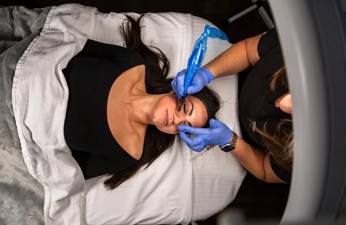 Microneedling $325 (Single) / $900 (Series of 3)